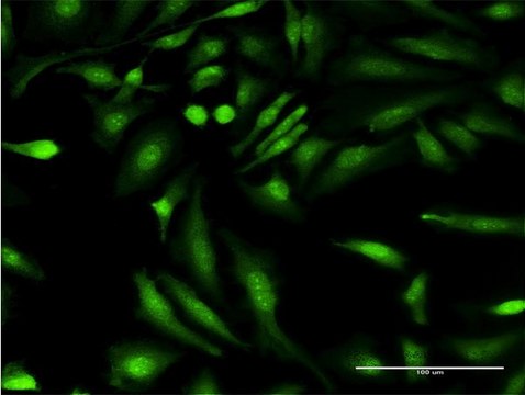 Monoclonal Anti-HGD antibody produced in