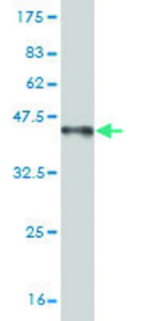 Monoclonal Anti-FOXP1 antibody produced in
