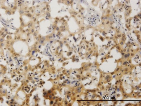 Monoclonal Anti-ZNF496 antibody produced in