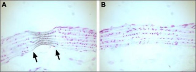 Anti-Calcium Channel (Cardiac ?1C Subunit)
