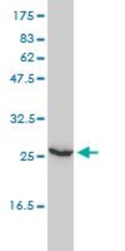 Monoclonal Anti-UBE2T antibody produced in