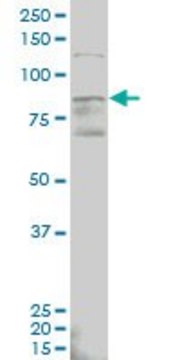 Monoclonal Anti-ALDH18A1 antibody produced in