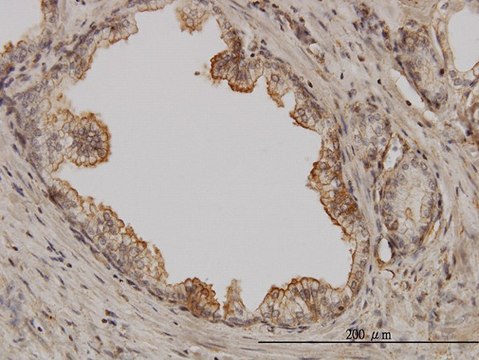 Monoclonal Anti-PAK1 antibody produced in