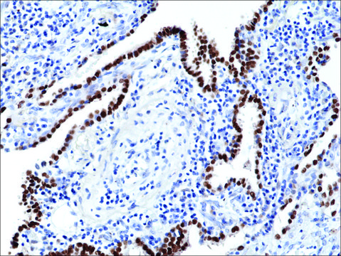 Anti-TTF1 (Thyroid transcription factor 1)