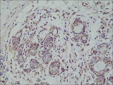 Anti-AKT (PH domain) antibody, Rabbit