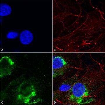 Monoclonal Anti-Lrrk2/Dardarin - Atto 390
