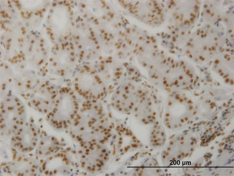 Monoclonal Anti-PPP3CA antibody produced in