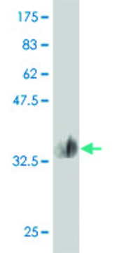 Monoclonal Anti-MMP28 antibody produced in