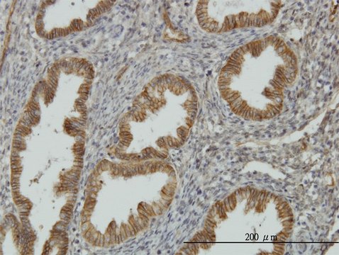 Monoclonal Anti-NDRG1 antibody produced in