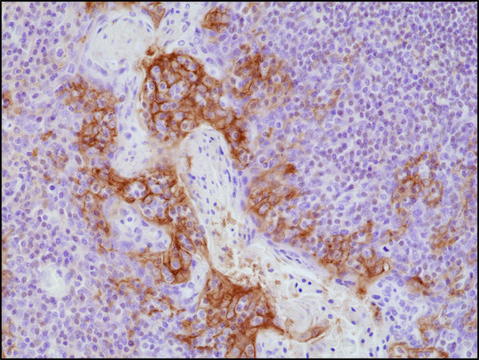 Anti-PD-L1antibody, Rabbit Monoclonal