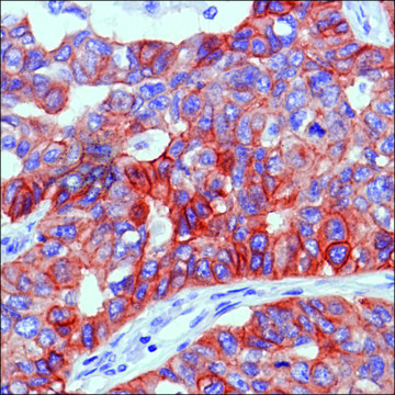 Anti-EGFR antibody, Rabbit monoclonal