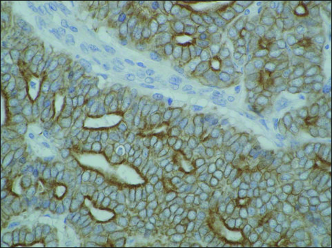 Monoclonal Anti-Cytokeratin (Pan-reactive) antibody produced
