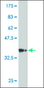 Monoclonal Anti-MGC2749 antibody produced in