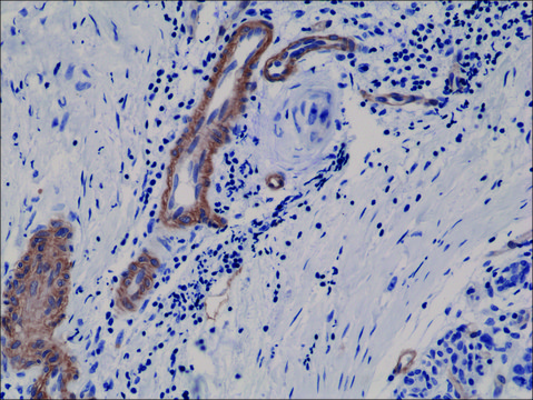 Anti-CD146 antibody, Rabbit monoclonal