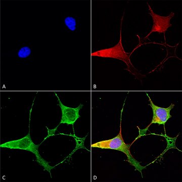 Monoclonal Anti-Gaba-B Receptor 2 -