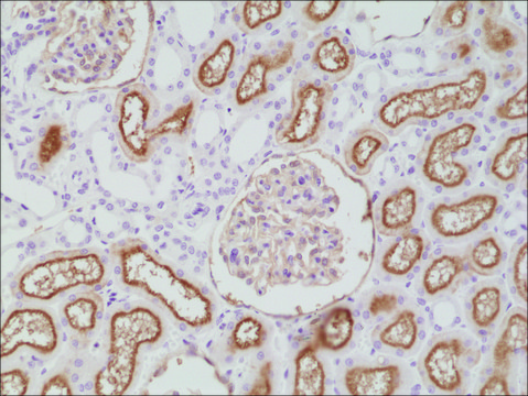 Anti-CD10 antibody, Rabbit monoclonal