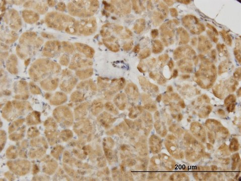 Monoclonal Anti-PDK2 antibody produced in