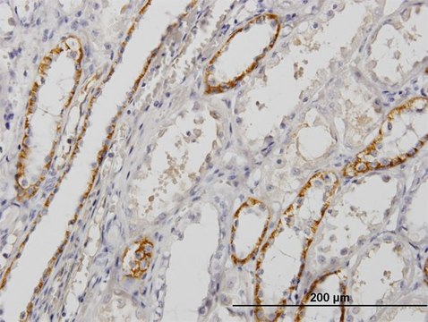 Monoclonal Anti-PALM antibody produced in