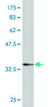 Monoclonal Anti-SPDEF antibody produced in