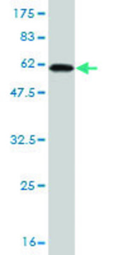 Monoclonal Anti-RLBP1 antibody produced in