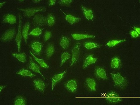 Monoclonal Anti-UBE2G1 antibody produced in