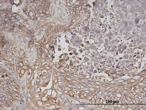 Monoclonal Anti-ERBB3 antibody produced in