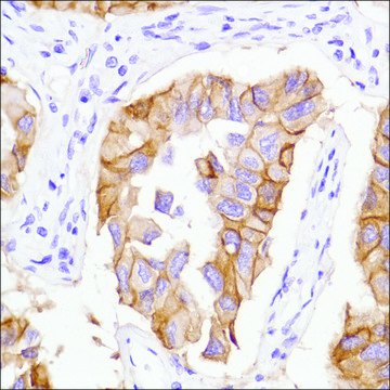 Anti-EGFR antibody, Rabbit monoclonal