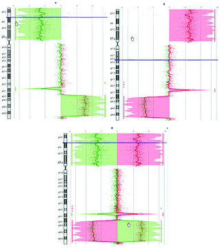 GenomePlex® Complete Whole Genome Amplification