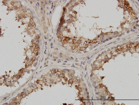 Monoclonal Anti-PSMB4 antibody produced in