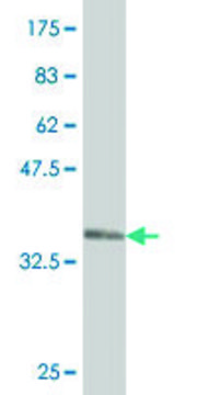 Monoclonal Anti-WDR36 antibody produced in