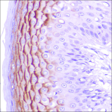 Anti-C4.4A/LYPD3 antibody, Rabbit monoclonal