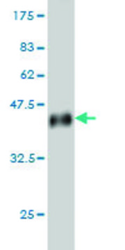 Monoclonal Anti-UPK1B antibody produced in