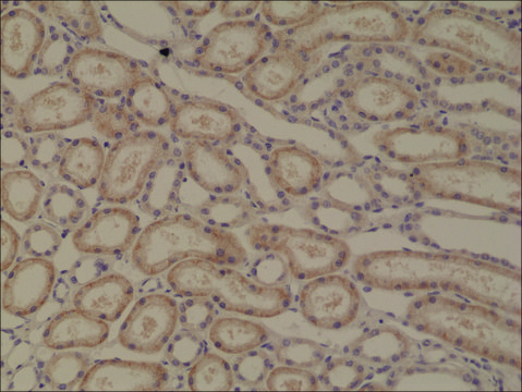 Anti-p120-catenin antibody, Rabbit monoclonal