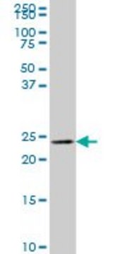 Monoclonal Anti-MLC1SA antibody produced in