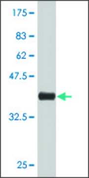 Monoclonal Anti-VMD2 antibody produced in