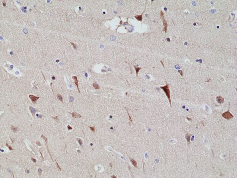 Anti-PSD-95 antibody, Rabbit Monoclonal