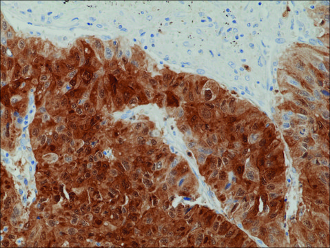 Anti-Arginase-1 (ARG1) antibody, Rabbit monoclonal