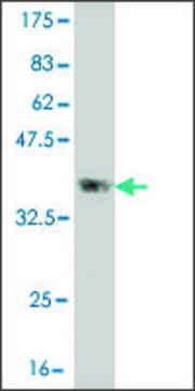 Monoclonal Anti-CLCA2 antibody produced in