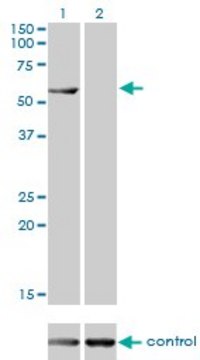 Monoclonal Anti-CESK1 antibody produced in