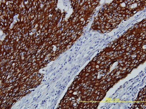 Monoclonal Anti-FGFR2 antibody produced in