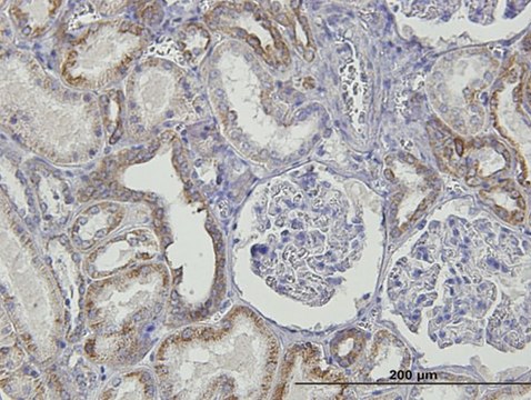 Monoclonal Anti-TNFRSF14 antibody produced in