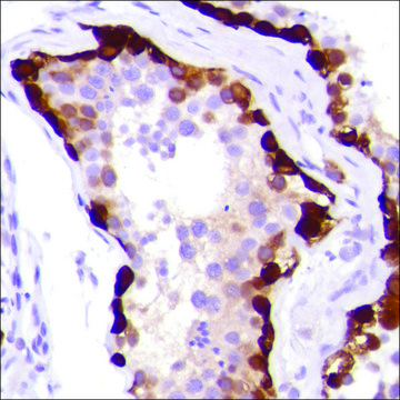 Anti-MAGE-A1 antibody, Rabbit monoclonal