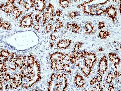 Anti-Prostein (SLC45A3) Rabbit Monoclonal Antibody