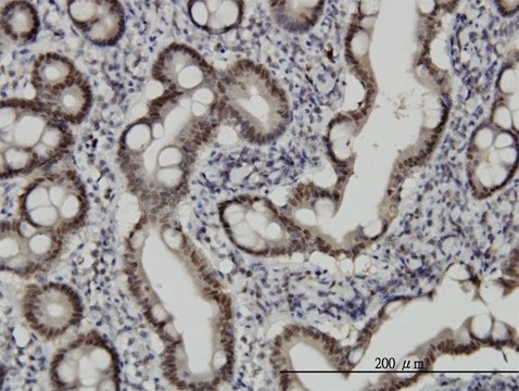 Monoclonal Anti-CHFR antibody produced in
